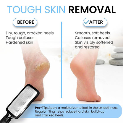 Colossal Foot Rasp Foot File and Callus Remover. Best Foot Care Pedicure Metal Surface Tool to Remove Hard Skin. Can Be Used on Both Wet and Dry Feet, High Grade Stainless Steel File2